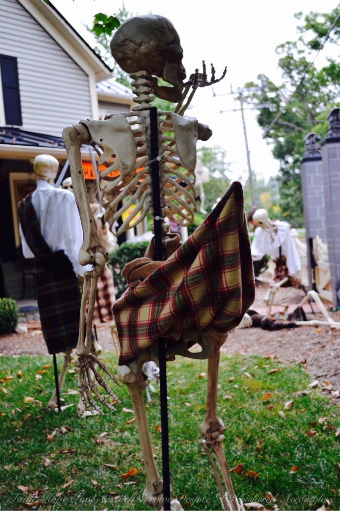 Scottish Skeleton Clan Army | Faith, Hope, Love, & Luck Survive Despite A Whiskered Accomplice